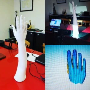 Biomedical Reverse Engineering - arm scan process collage